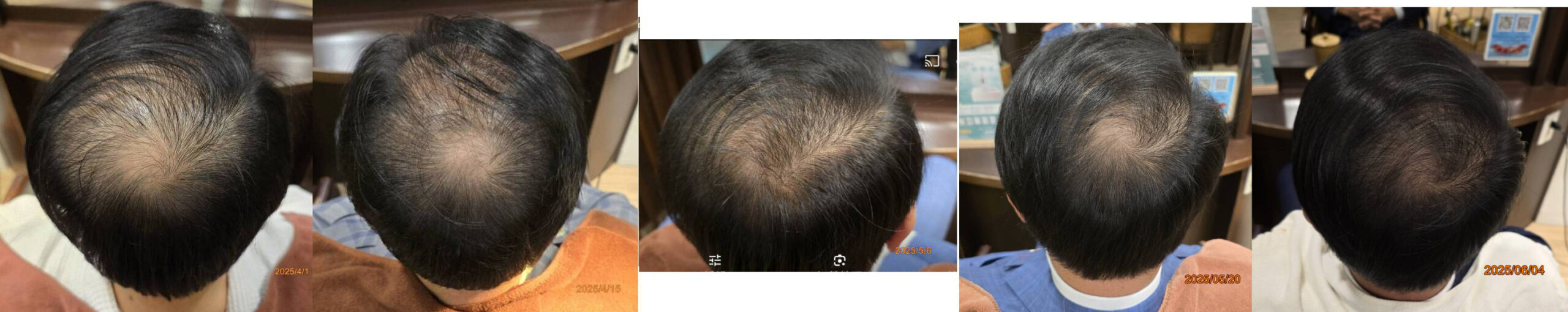 New Hair Regrowth Combo - Image 6
